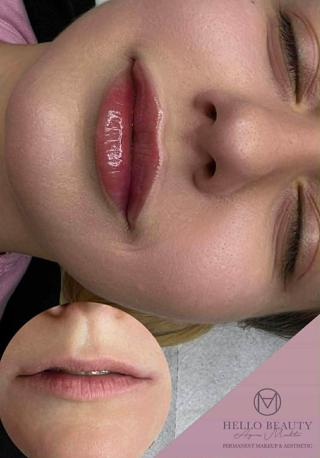 Modelowanie ust przed i po – efekt Hello Beauty Kołobrzeg