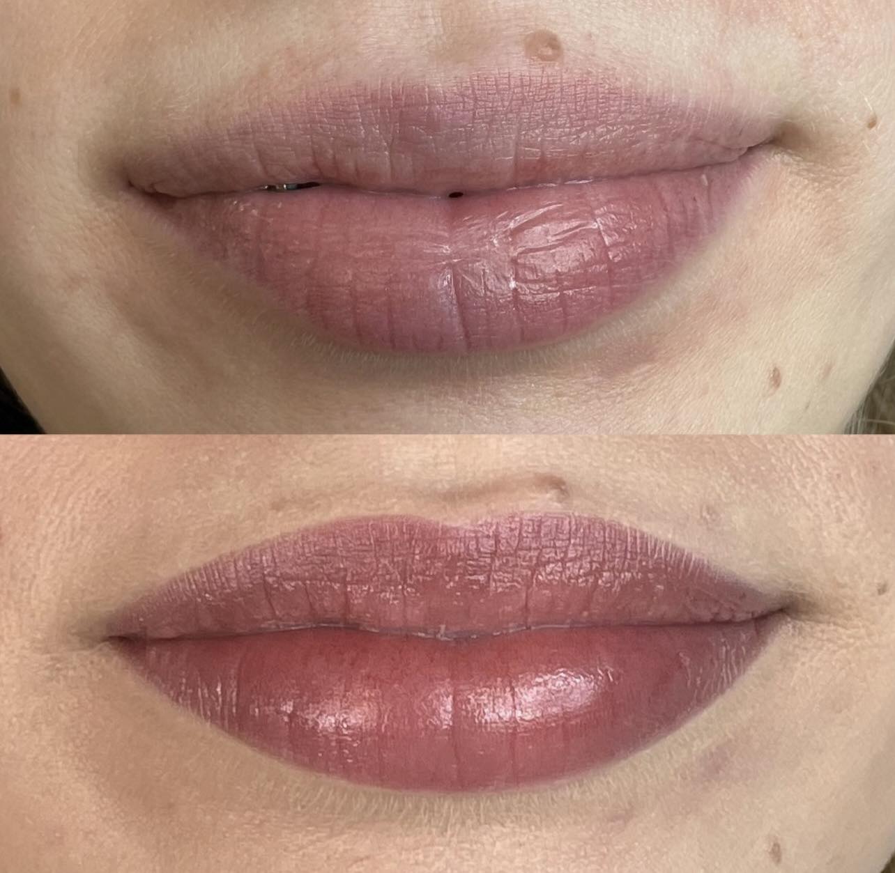 Wygojone usta permanentne przed i po – Hello Beauty Kołobrzeg