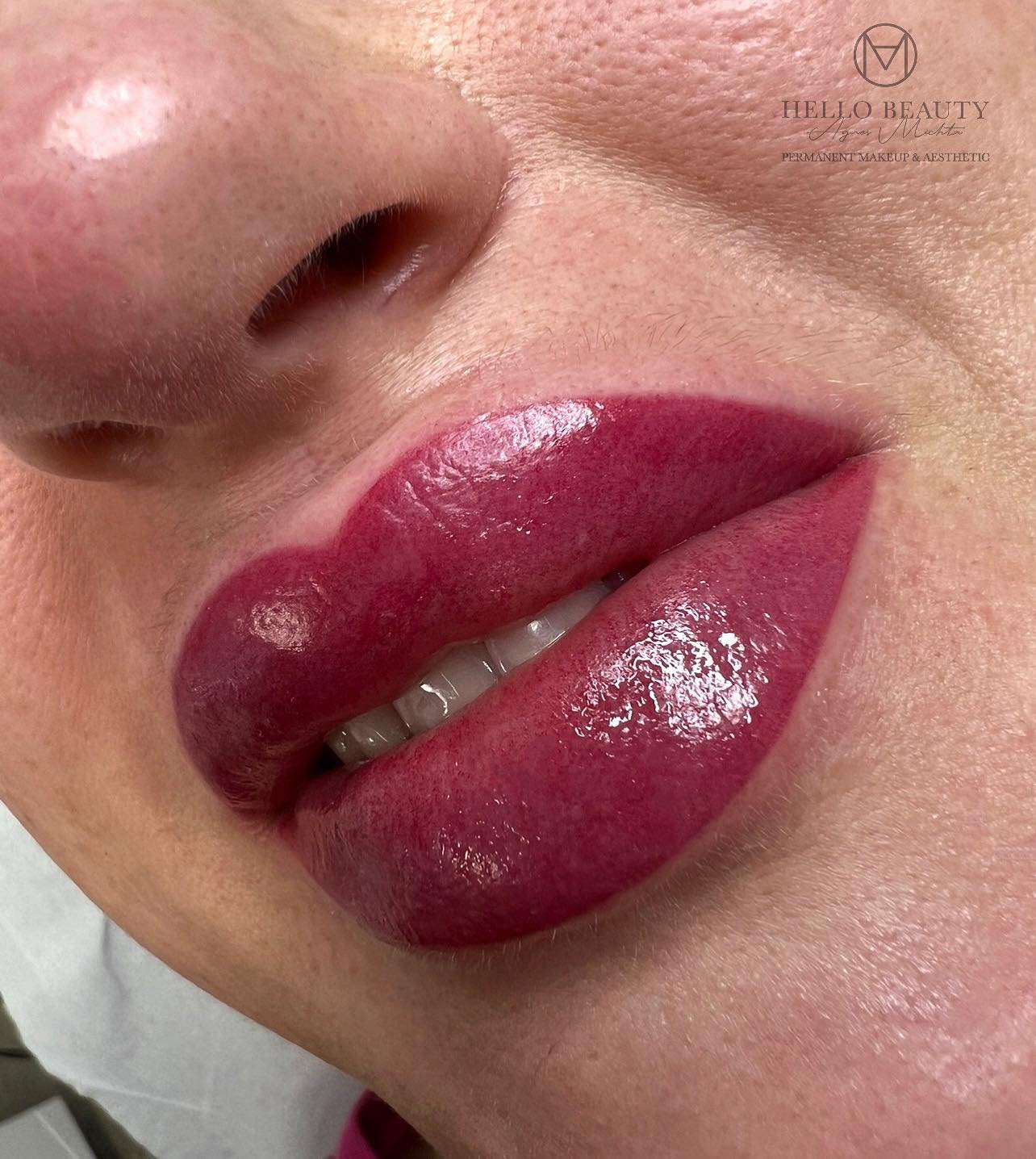 Usta permanentne – realizacja 2