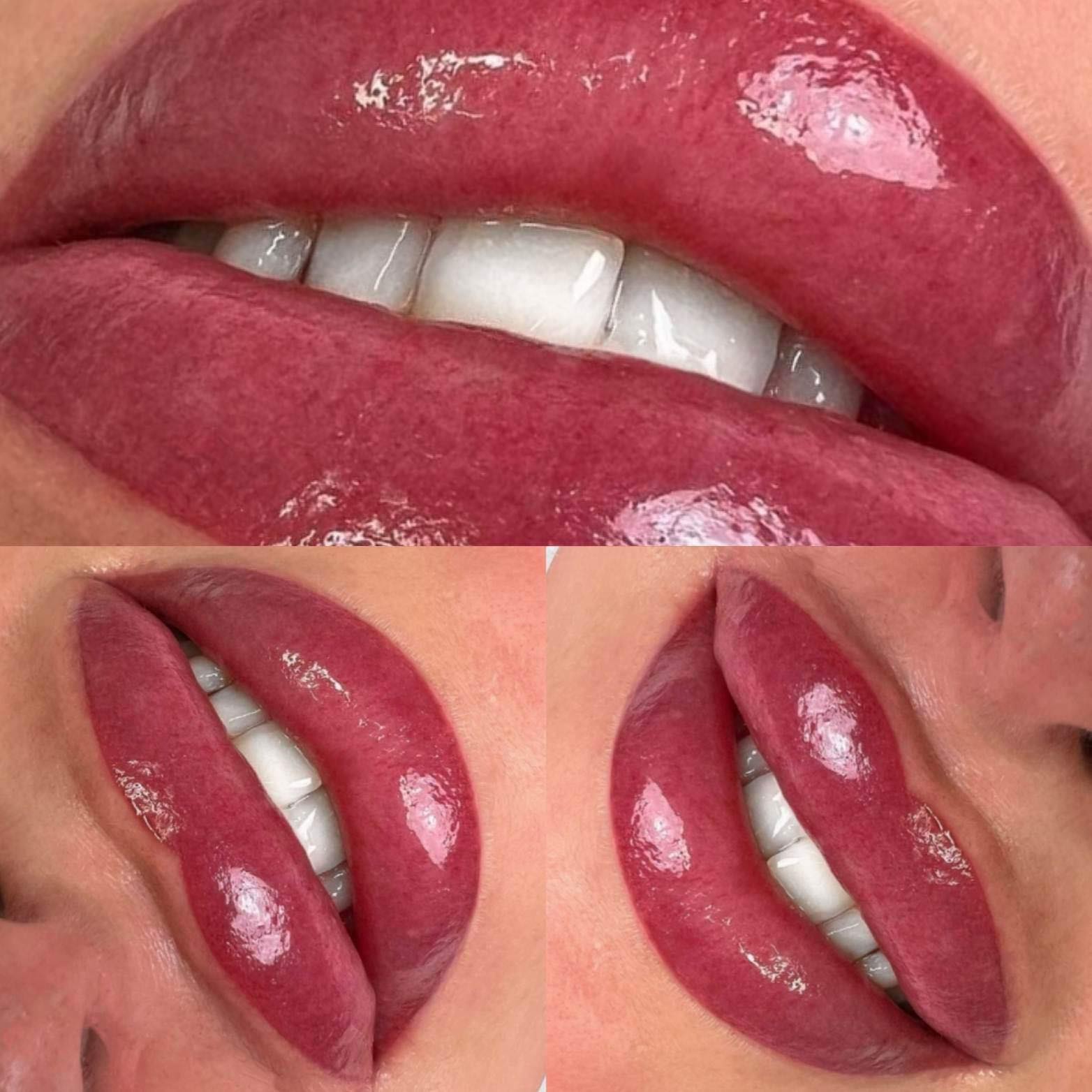 Usta permanentne – realizacja 3