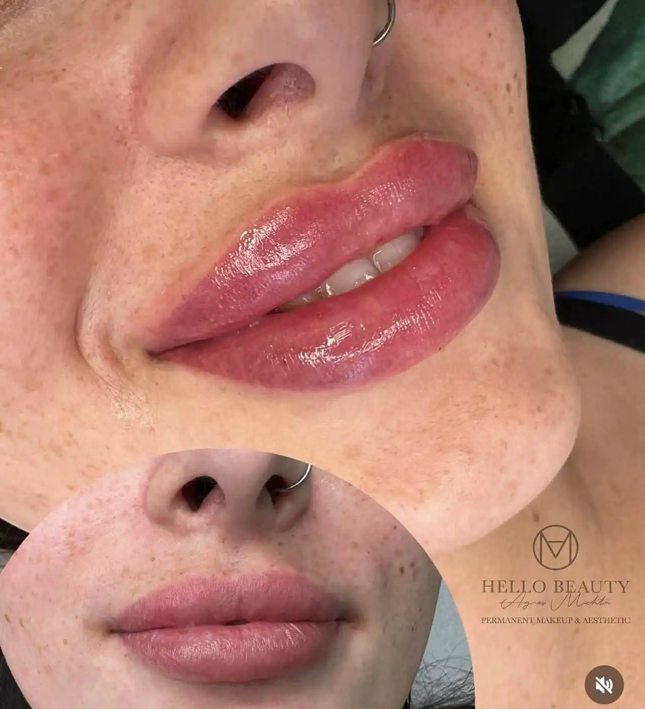 Modelowanie ust przed i po – transformacja Hello Beauty
