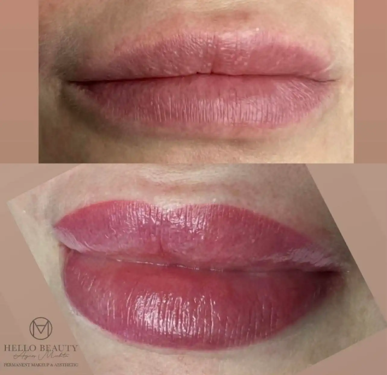 Usta permanentne bezpośrednio po zabiegu – transformacja Hello Beauty