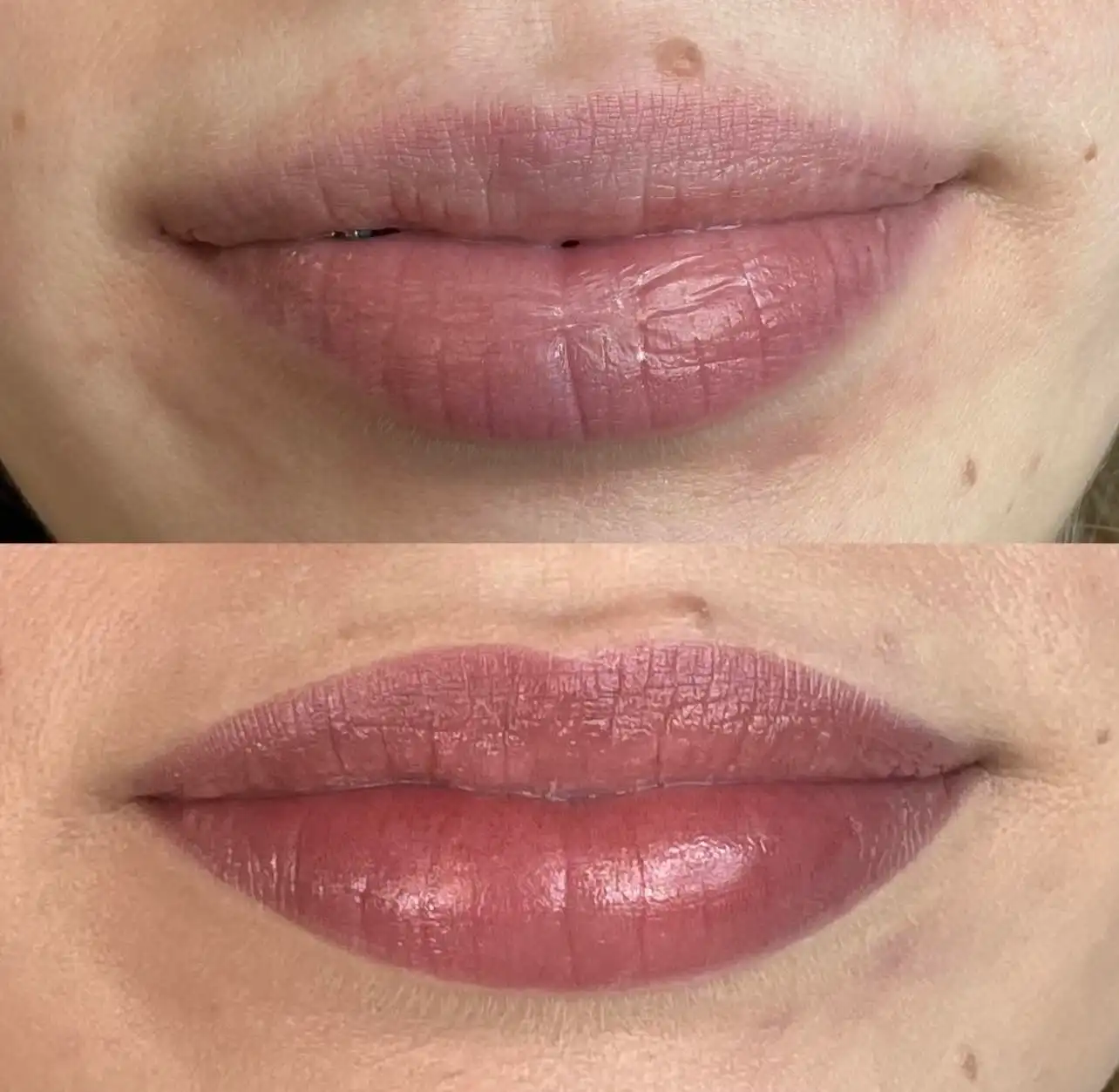 Wygojone usta permanentne przed i po – Hello Beauty Kołobrzeg